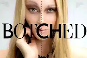 Botched logo